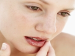 Cure Chapped Lips Aid