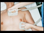 Heart Disease Signs Heart Problem