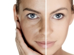Get Rid Large Pores Naturally