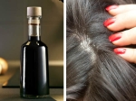 Vinegar Dandruff