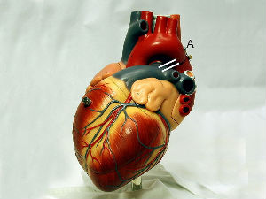 heart