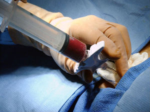 Blood Canceer Treatment Blood Canceer Treatment