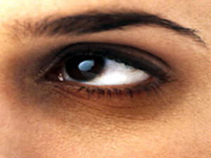 Dark Eyes Circles Dark Eyes Circles
