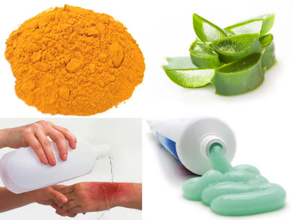 immediate burn remedies at home immediate burn remedies at home