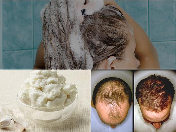 How To Use Garlic Shampoo For Hair Loss