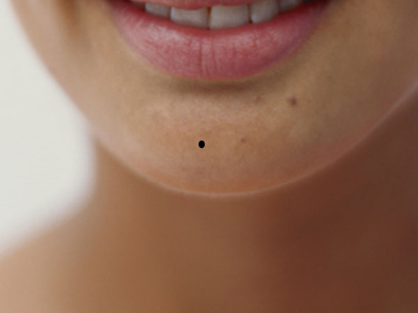 9. ठà¥à¤¡à¤¼à¥ पर तिल: