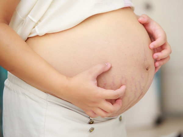 ICP during pregnancy