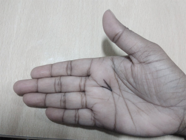 टूटी ह्रदय रेखा मष्तिस्क रेखा से मिले
