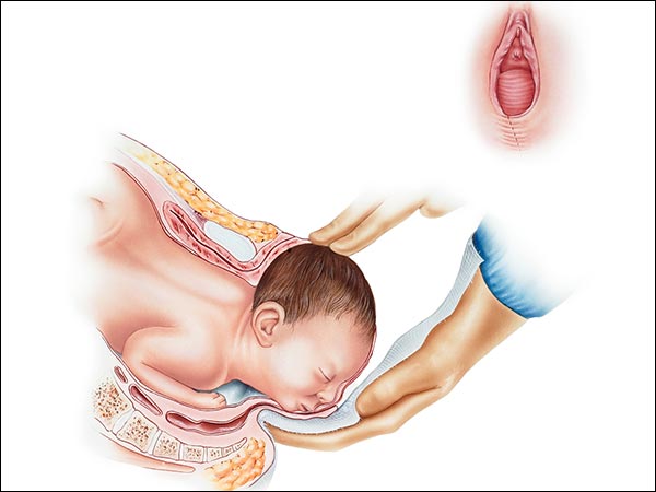 क्या आपको वजाइनल सीडिंग चुनना चाहिए?
