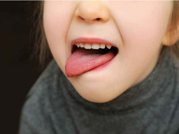 पेरिओडॉन्टल (Periodontal)