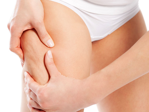 सेल्युलाइट करे कम सेल्युलाइट करे कम