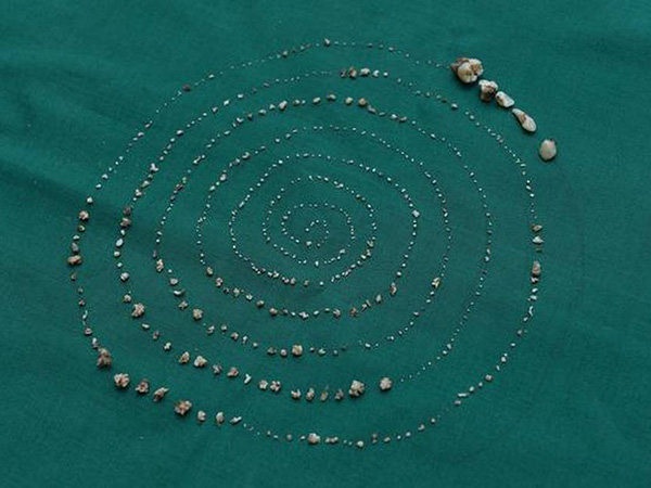 3 साल की उम्र से थी बच्चे को तकलीफ