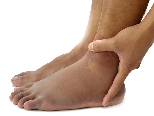 सूजन और जोड़ों से राहत