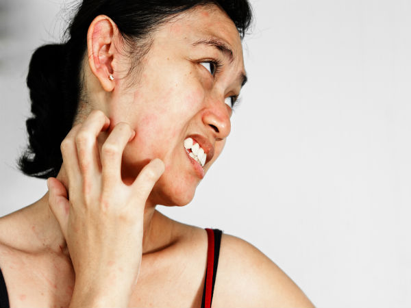 चेहरे पर सूजन की समस्या चेहरे पर सूजन की समस्या
