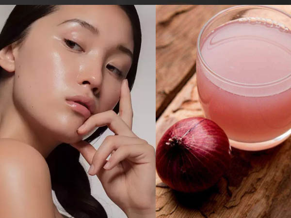 ग्लोइंग स्किन के लिए प्याज का रस ग्लोइंग स्किन के लिए प्याज का रस