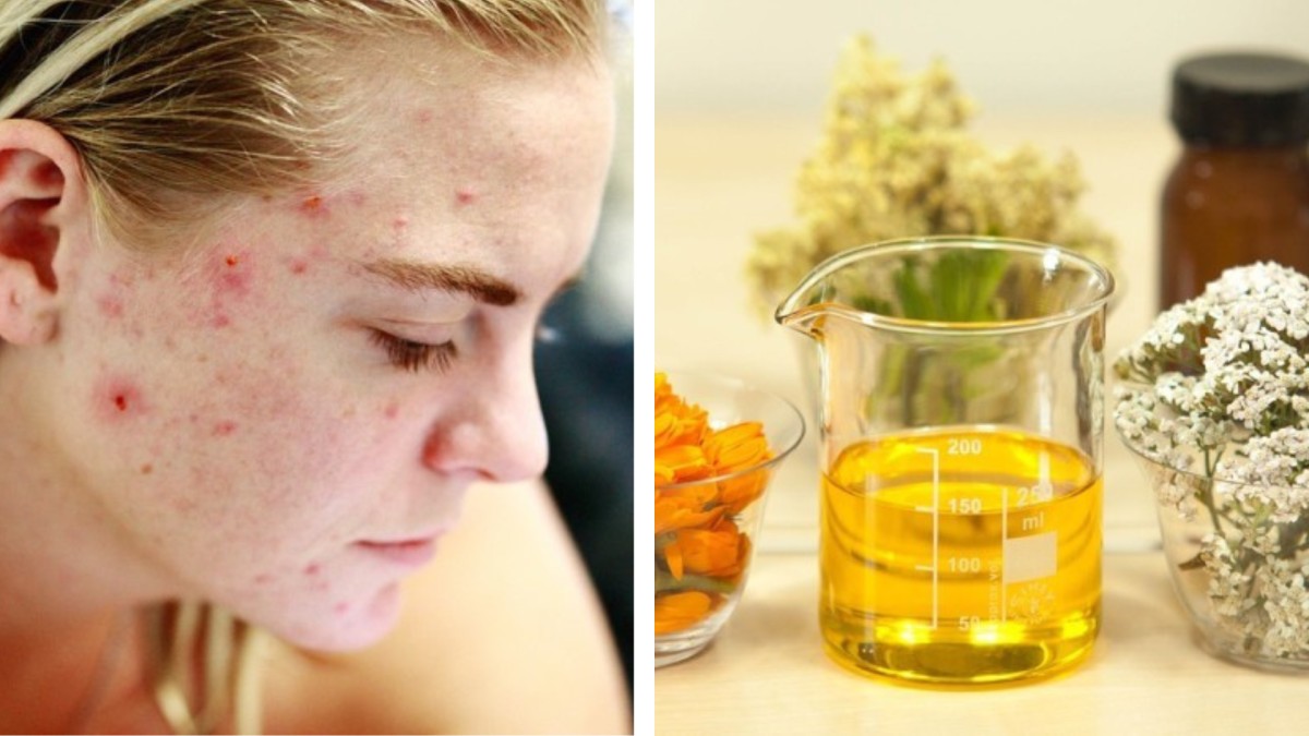 जोजोबा ऑयल से मिलेगी खिली खिली त्वचा Beauty Benefits of jojoba oil