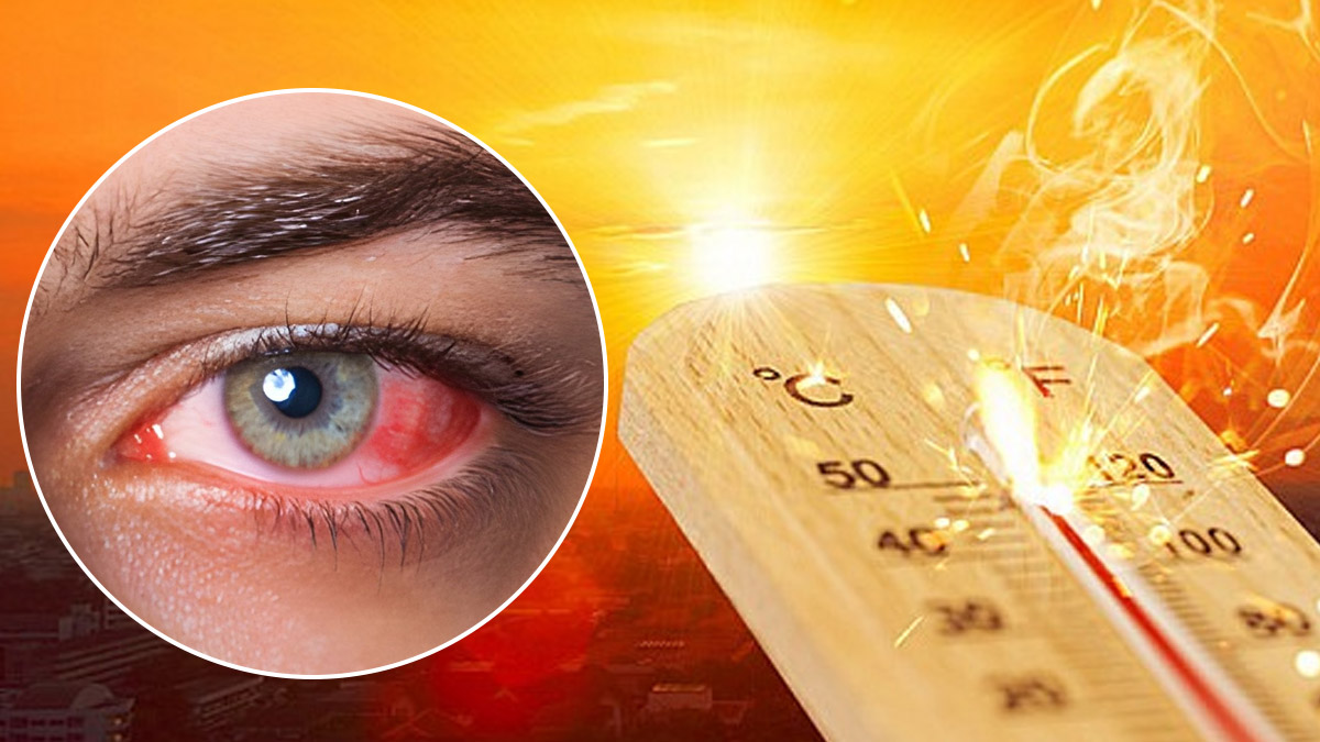 Eye Stroke : चिलचिलाती गर्मी से बढ़ा 'आई स्ट्रोक' का खतरा, जानें 49 ड ...