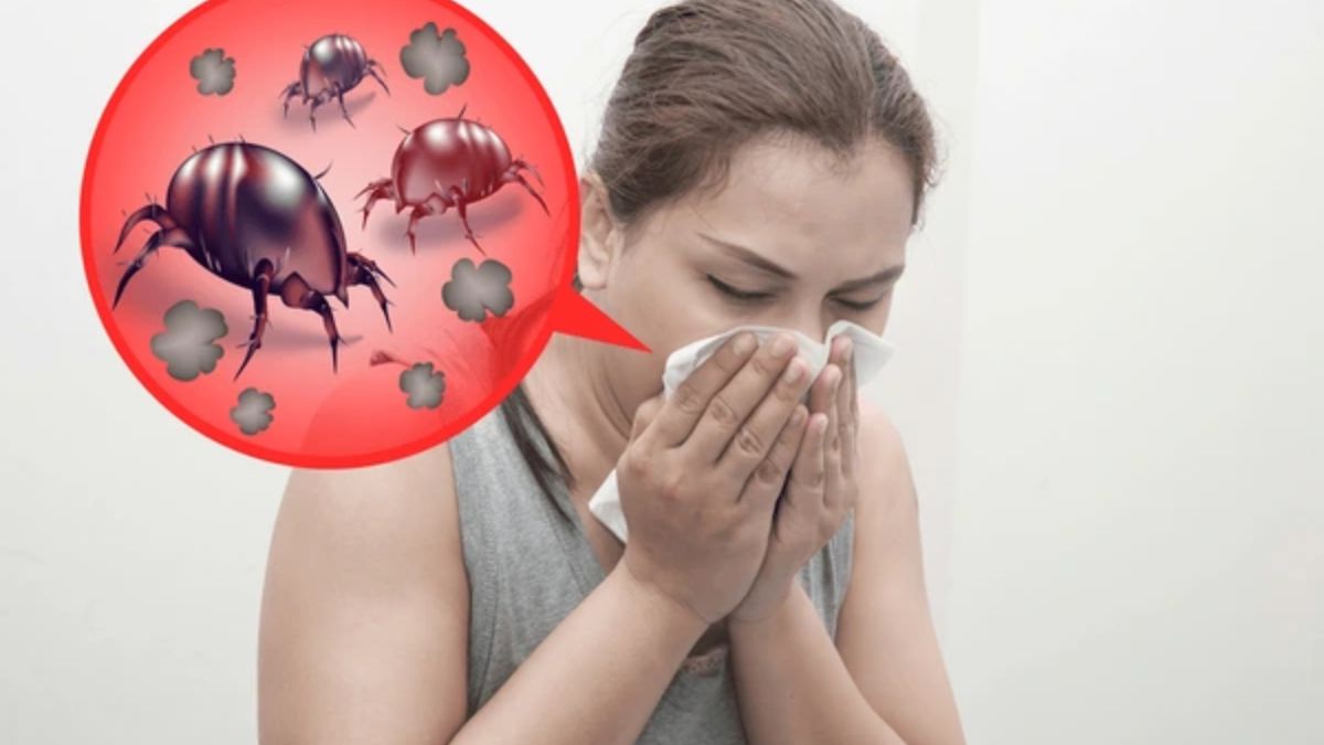 Dust Mite Allergy आंखों से नहीं दिखते है डस्टमाइट, स्किन और डस्‍ट