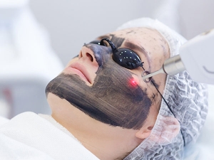 What Is A Carbon Laser Facial Know The Benefits Of The Charcoal Peel And Cost What Is A Carbon Laser Facial Know The Benefits Of The Charcoal Peel And Cost